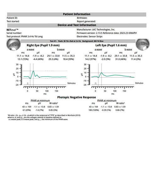 PhNR_report