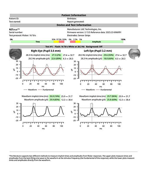 Flicker-16-Td.s_report_2
