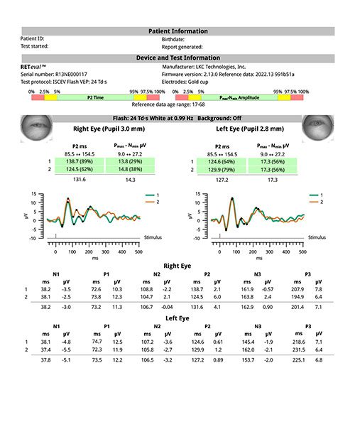 VEP-ISCEV-flash-24-with-reference-data_report_2
